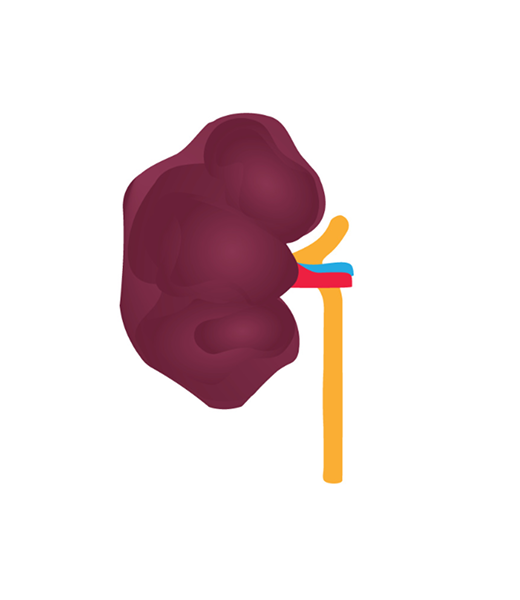Kidney Stage 5 Image